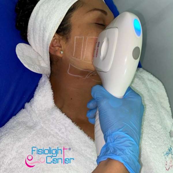 Hifu Lifting Facial  Fisiolight Center Sincelejo Sucre